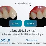Caso: Sensibilidad dental